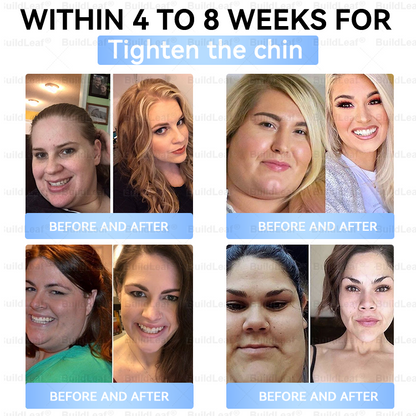 🏥FDA Store |❤️𝐵uil𝗱𝐿ea𝐟® 𝑮𝐋𝑃-1 Slim & Firm 𝑁ano 𝑀icroneedle 𝑃atch with Collagen,Turmeric&Matrixyl 3000 丨Obesity,Cardiovascular Diseas, Diabetes, Sleep Apnea, Joint Problems and More