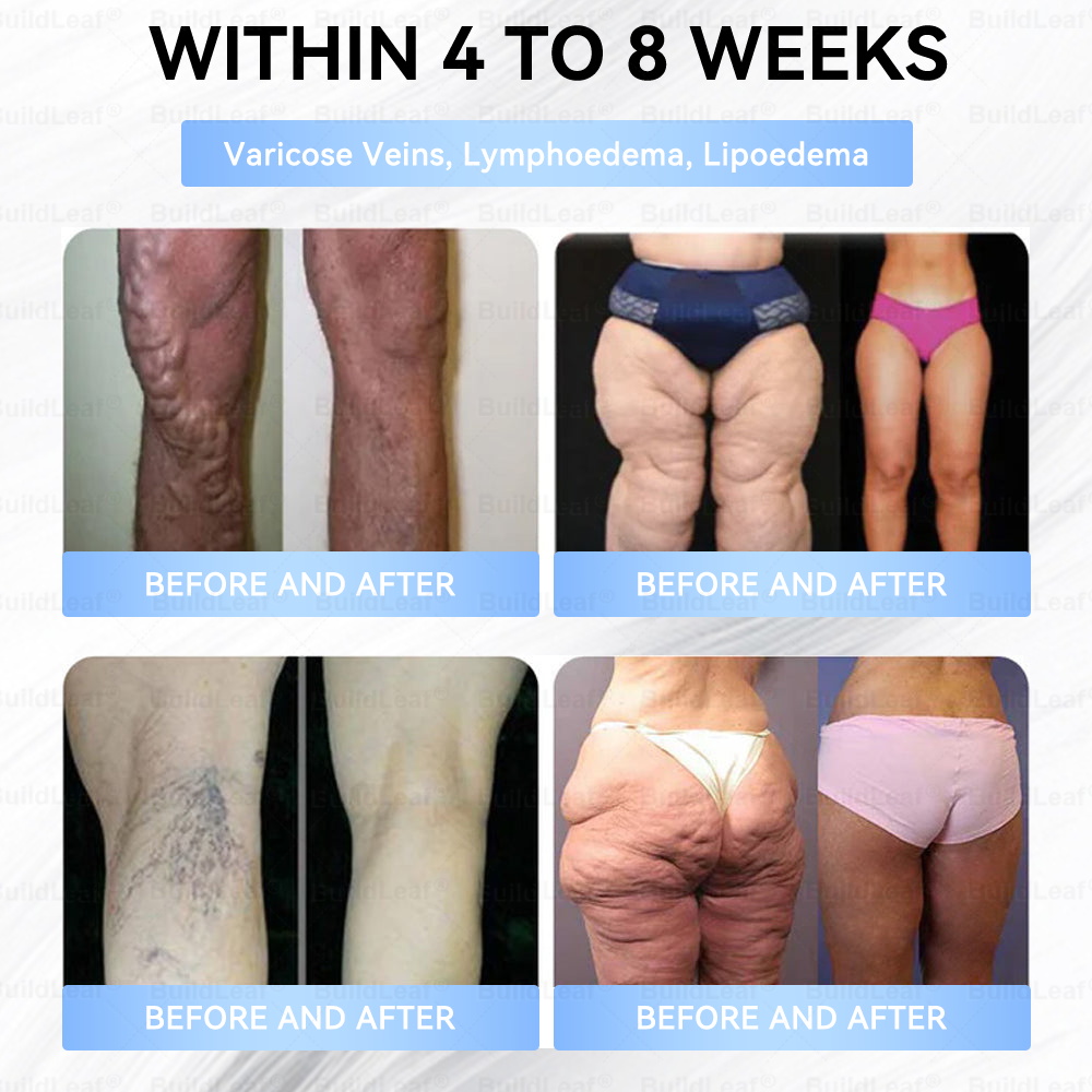 🏥FDA Store |❤️𝐵uil𝗱𝐿ea𝐟® 𝑮𝐋𝑃-1 Slim & Firm 𝑁ano 𝑀icroneedle 𝑃atch with Collagen,Turmeric&Matrixyl 3000 丨Obesity,Cardiovascular Diseas, Diabetes, Sleep Apnea, Joint Problems and More