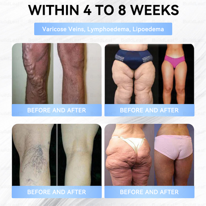 🏥FDA Store |❤️𝐵uil𝗱𝐿ea𝐟® 𝑮𝐋𝑃-1 Slim & Firm 𝑁ano 𝑀icroneedle 𝑃atch with Collagen,Turmeric&Matrixyl 3000 丨Obesity,Cardiovascular Diseas, Diabetes, Sleep Apnea, Joint Problems and More