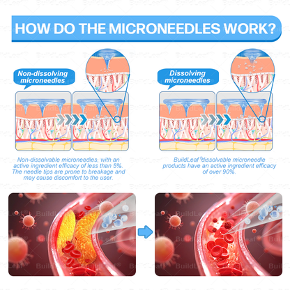 🏥FDA Store |❤️𝐵uil𝗱𝐿ea𝐟® 𝑮𝐋𝑃-1 Slim & Firm 𝑁ano 𝑀icroneedle 𝑃atch with Collagen,Turmeric&Matrixyl 3000 丨Obesity,Cardiovascular Diseas, Diabetes, Sleep Apnea, Joint Problems and More