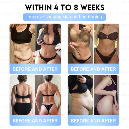 𝐁𝐮𝐢𝐥𝗱𝐋𝐞𝐚𝐟®𝐒𝐥𝐢𝐦 & 𝐅𝐢𝐫𝐦 𝐍𝐚𝐧𝐨 𝐌𝐢𝐜𝐫𝐨𝐧𝐞𝐞𝐝𝐥𝐞 𝐏𝐚𝐭𝐜𝐡 𝐰𝐢𝐭𝐡 𝐌𝐨𝐫𝐢𝐧𝐠𝐚, 𝐎𝐦𝐞𝐠𝐚-𝟑, 𝐂𝐨𝐥𝐥𝐚𝐠𝐞𝐧 𝐏𝐞𝐩𝐭𝐢𝐝𝐞𝐬, 𝐍𝐀𝐃 & 𝐍𝐌𝐍 𝐟𝐨𝐫 𝐎𝐛𝐞𝐬𝐢𝐭𝐲, 𝐂𝐚𝐫𝐝𝐢𝐨𝐯𝐚𝐬𝐜𝐮𝐥𝐚𝐫 𝐃𝐢𝐬𝐞𝐚𝐬𝐞, 𝐃𝐢𝐚𝐛𝐞𝐭𝐞𝐬, 𝐒𝐥𝐞𝐞𝐩 𝐀𝐩𝐧𝐞𝐚, 𝐉𝐨𝐢𝐧𝐭 𝐏𝐫𝐨𝐛𝐥𝐞𝐦𝐬, 𝐒𝐤𝐢𝐧 𝐅𝐢𝐫𝐦𝐢𝐧𝐠, 𝐀𝐧𝐭𝐢-𝐀𝐠𝐢𝐧𝐠, 𝐚𝐧𝐝 𝐌𝐨𝐫𝐞🔥🔥