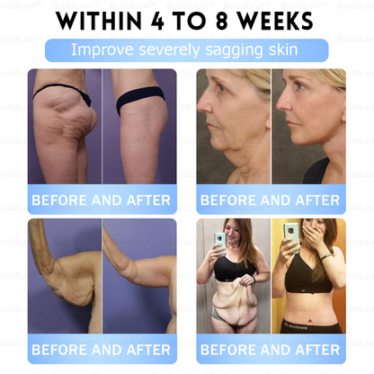🏥FDA Store |❤️𝐵uil𝗱𝐿ea𝐟® 𝑮𝐋𝑃-1 Slim & Firm 𝑁ano 𝑀icroneedle 𝑃atch with Collagen,Turmeric&Matrixyl 3000 丨Obesity,Cardiovascular Diseas, Diabetes, Sleep Apnea, Joint Problems and More